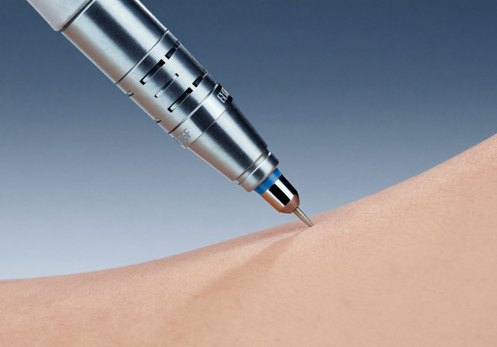 Microneedling